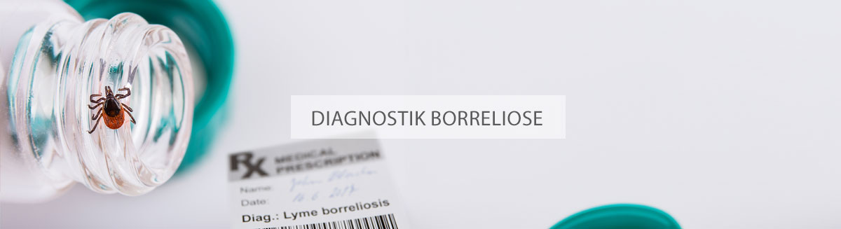 Borreliose Diagnose
