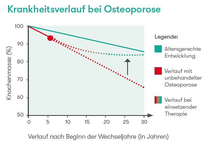 Krankheitsverlauf bei Osteoporose
