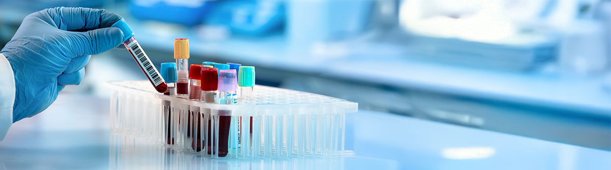Die wichtigsten Blutwerte