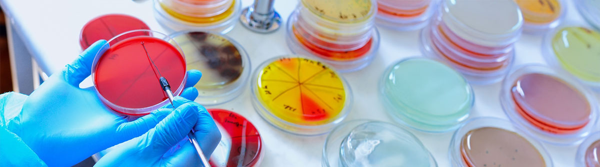 Werte Darm-Mikrobiom Analyse 